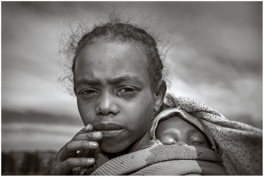 Etiopia